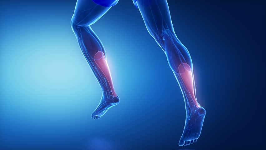 Header of Achilles tendon