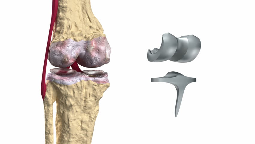 types-of-hinge-joints