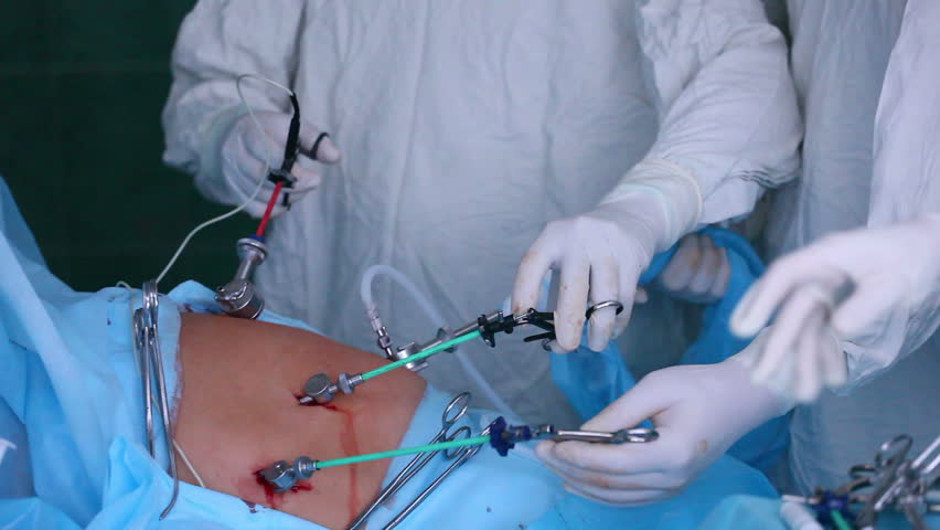 Surgeon Stitching Up Abdomen Stock Footage Video 1899592 - Shutterstock