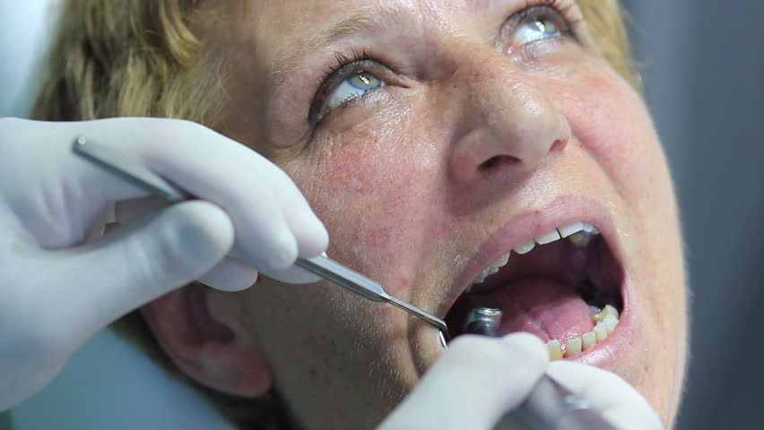 Closeup Of Dentist Using Dental Drill On Patients Teeth Stock Footage