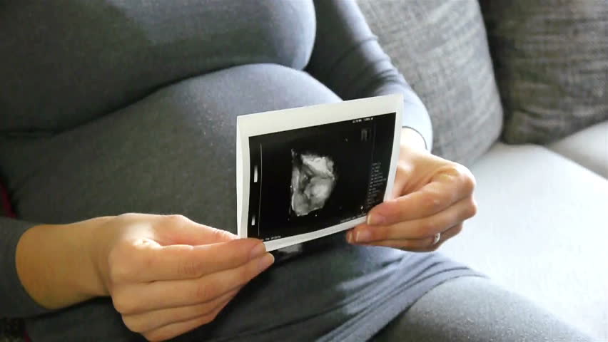 Image result for pregnant mother ultrasound