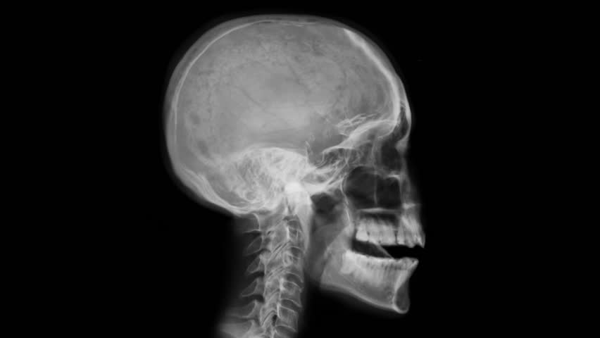 Electrical Neural Signal Transmission Activity Radiating From