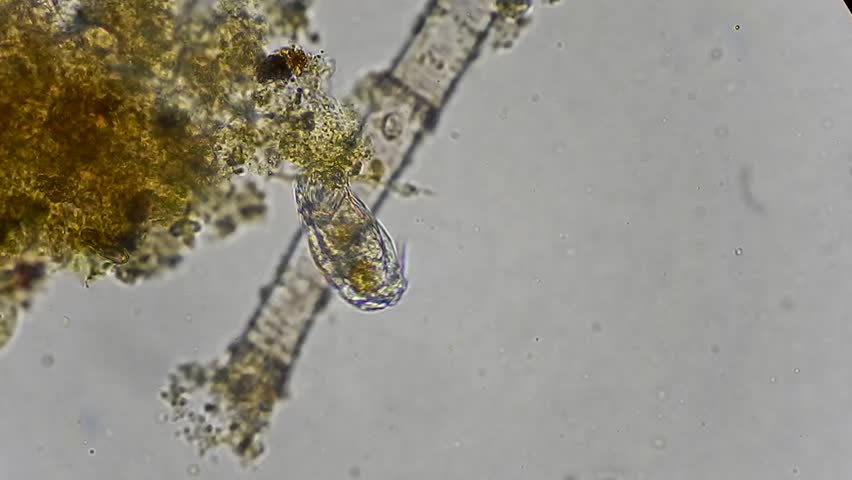 Live Microscopic Animal Rotifer Feeding Under Microscope 400x Stock ...