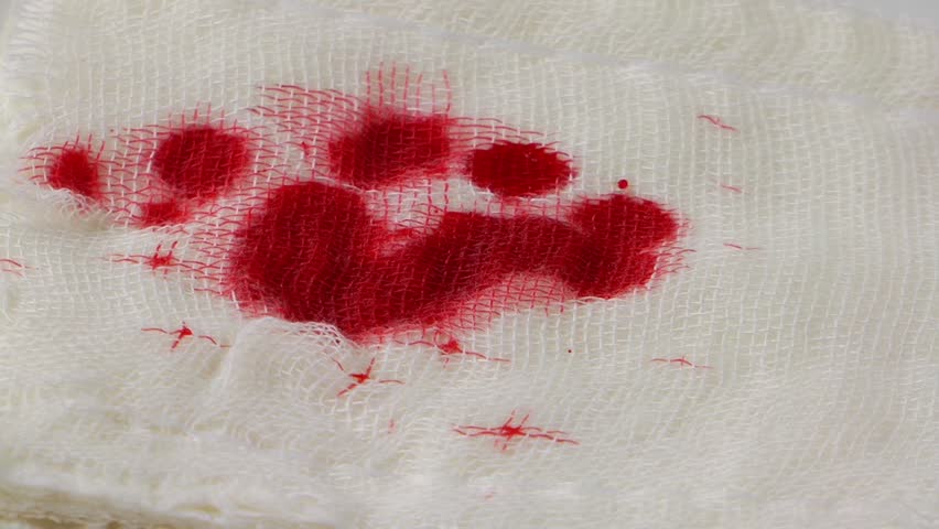 Blood Drops On Gauze Bandage Stock Footage Video 6459647 - Shutterstock