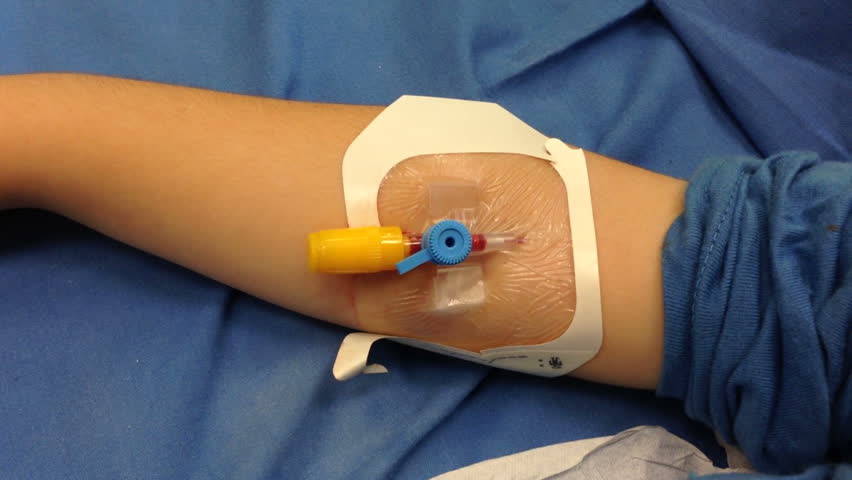 Child With IV Connected To His Arm During Treatment In A 