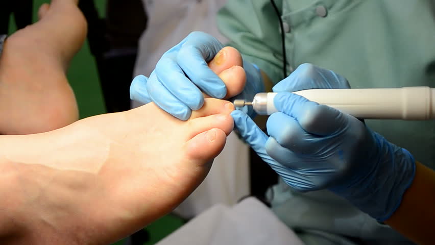 Man Getting Medical Pedicure Stock Footage Video 1060645 - Shutterstock